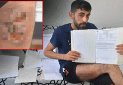12 yıl önce arkadaşının tekmesiyle açılan yara, hayatını kabusa çevirdi!