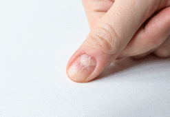 Hemen kontrol edin! Kanserin en erken belirtisiymiş