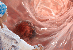 Erken dönemde yakalayın: Kanser olma riskinizi öğrenmek artık çok kolay!