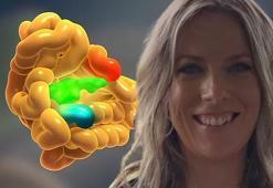 Hemşireler bile hiç duymamıştı! 40 yaşında nadir görülen kanserden öldü