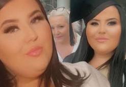 Yüzündeki yaralara 'sivilce' dediler... Genç kadının gizemli ölümü