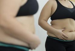 Sezaryen göbeği nasıl gider? Sezaryende sarkan göbek nasıl eritilir?