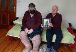 Sivrisinek ısırığı hayatını kararttı! 9 yıldır inan içine çıkamıyor