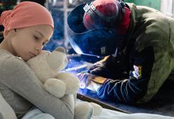 Her yıl yüzlerce çocukta ortaya çıkıyor! Meslek seçimi bile hastalığı tetikliyor
