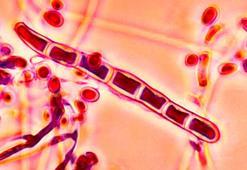 Uzmanlar uyardı: Dünya buna hazır değil! İki kişide tehlikeli mantar görüldü