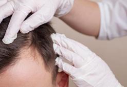 Keratin takviyeleri saç derisi sağlığını olumlu yönde etkiler mi?