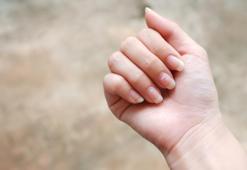 Türk Dermatoloji Derneği'nden korkutan uyarı: Hemen kontrol edin, melanom kanseri belirtisi!
