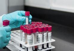 İngiltere’de bulaşıcı cinsel hastalıklar rekor seviyeye yükseldi