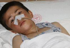 Ayı saldırısında uğrayan çocuk hayati tehlikeyi atlattı