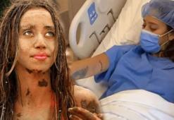 Survivor Zeynep Alkan: Bu yaz iş yok, ameliyat var