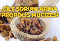 Kolajen haplarını çöpe attıran formül! Botoks etkisiyle cilde gençlik aşılıyor, tek damlası bile yetiyor