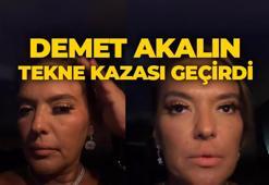Demet Akalın konser yolunda tekne kazası geçirdi!
