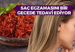 Egzama, kepek, kaşıntı ve sivilceden eser bırakmıyor! Gece sürünce koparak dökülen saçları durduruyor