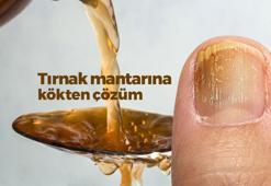 İbrahim Saraçoğlu tırnak mantarı bitkisel tedavisi: Ayak altına yapın, bu yöntemle 3 günde kurtulun!