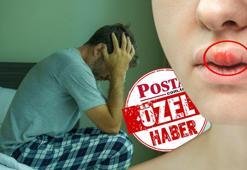 Belirti vermeden ilerleyip gençleri ölüme sürüklüyor! Tehlikeli hastalıkta vaka sayısı yüzde 128 arttı