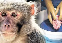 Domuz böbreğiyle 758 gün yaşadı