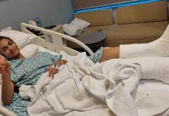 Kesilmek zorunda denilen bacağını 'Yüzyılın Mucize'si kurtardı