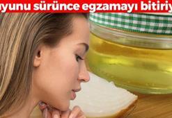 Egzama, kepek ve kaşıntıdan tek malzemede kurtulun: Mutfağınızda bulunan altın besin: Suyunu sürünce kuruluğu bitiriyor