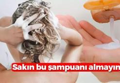 Bu şampuanı evinize bile sokmayın! Kel bırakıyor: Egzama ve kepek oluşturuyor, kullanan bin pişman