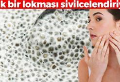 Bu besinler tüm yüze sivilce bastırıyor! Ağzınıza bile sürmeyin Tek lokmada yüzü haritaya çeviriyor