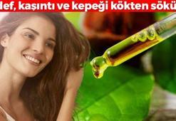 Egzama ilacından bile daha etkili! Sedef, kaşıntı ve kepeği kökten söküyor: Şampuanın içine 1 damla ekleyin