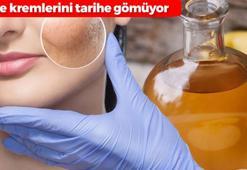 Pahalı leke kremlerini tarihe gömen yöntem! Gece sürünce lekeleri silgi gibi siliyor: Sirkeyle karıştırın