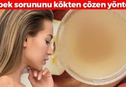 Saçta kepek, egzama bırakmıyor! Tek bir damlası bile yetiyor: Elma sirkesiyle karıştırın
