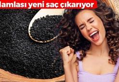 Kafasına sürenin saçı çoğalıyor! 1 damlasını gece boyunca köklerde bekletin: Gürül gürül saç çıkaran formül