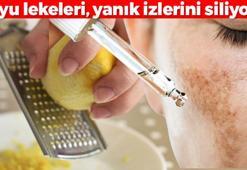 Koyu lekeleri, yanık izlerini, güneş hasarlarını silgi gibi siliyor! Mutfağınızdaki sihirli formül: 4 malzemeli bu maske cilt tonu eşitliyor