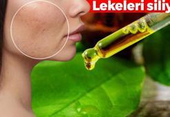 Güneş lekelerini tek kalemde siliyor! Yüzünüze 1 damla uygulayın, cildi güneş gibi aydınlatıyor