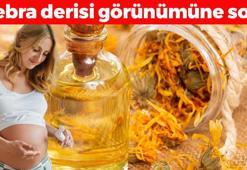 Deri çatlaklarına son! Pürüzsüz bir cilt sağlıyor, 1 haftada tüm izleri yok ediyor!