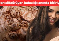 C vitamininde limonu solluyor: İdrarı söktürüp kabızlığı bitiriyor, kötü kolesterolü silip atıyor
