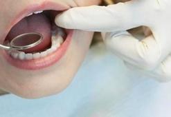 Diş kanaması orucu bozar mı? Diyanet açıkladı! Diş kanaması orucu bozar mı, kaza gerektirir mi?