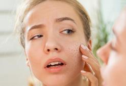 Aşırı kuruluk, sivilce, kızarıklık! Cilt bariyeriniz bozulmuş olabilir