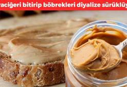 Kaşık kaşık yiyoruz ama böbrekleri diyalize sürüklüyor! Kahvaltıların favorisi, damarları tıkayıp ömürden 10 yıl götürüyor! Karaciğeri bitiren de oymuş