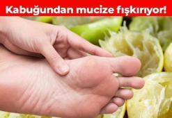 1 gecede nasıra veda! Kabuğunu kullanarak evde nasırdan kurtulmak çok kolay
