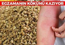 Egzamayı unutturan besin! Pul pul dökülmeyi anında bitiriyor