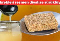 Yemeklere kaşık kaşık katıyoruz ama böbrekleri diyalize sürüklüyor! Ölmekten beter edip damarları tıkıyor, organları çürütüp ömrü kısaltıyor!