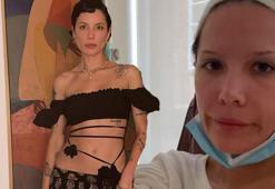 Halsey'den üzen haber! Meğer sessizce lösemiye karşı savaş veriyormuş