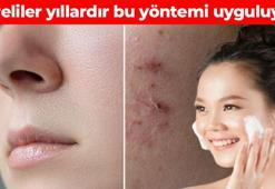 Korelilerden cilt bakımı için altın değerinde yöntem! Meğer çaresi çok basitmiş: Siyah noktaları vakum gibi çekiyor, yağ bezelerini söküp atıyor, cildiniz 20 yaş gençleştiriyor