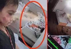 Anaokulunda dehşet! Uyuyan çocuğu 13 yerinden ısırdı