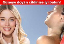 Yaz güneşinin izlerini taşımayın! Kumsalda güneşlendikten sonra mutlaka bunu yapın: Erken yaşlanmak istemeyenlere ipuçları