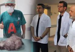 Karın ağrısıyla doktora giden adama şoke eden cevap! 'Çok nadir göreceğimiz bir vaka'