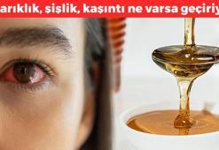 Gözdeki alerjiyi silip atıyor! 1 kaşık balla karıştırmak yetiyor: Kızarıklık, şişlik, kaşıntı ne varsa anında geçiriyor!