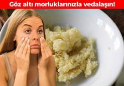 Kapatıcılarınızla vedalaşabilirsiniz! Göz altı morluklarını 2 malzemeyle geçirebilirsiniz: Daha aydınlık ve etkileyici bakışlar mümkün