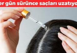1 ayda saçları 10 santim uzatıyor! Egzama, sedef ve kaşıntının kökünü kazıyıp saç dökülmesine de son veriyor!