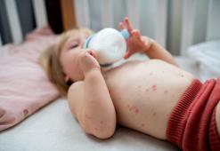 Yaz ishalinin nedeni deniz kirliliği olabilir