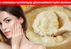 Siyah noktaları vakum gibi çekiyor! 2 malzemeyle hazırlanınca deri altına işliyor: Geniş gözenekleri asfalt gibi dolduruyor
