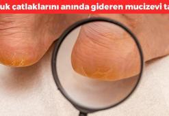 Gece yatmadan önce sürünce ayakları yumuşacık yapıyor! Bakımlı ayaklar için 1 damla yetiyor, cildi pürüzsüzleştiriyor, topuk çatlaklarını anında geçiriyor