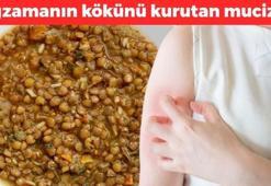 Kaşığın ucuyla yemek bile yetiyor! Egzama, sedef ve mantarın kökünü kazıyıp cildi bebek gibi yapıyor!